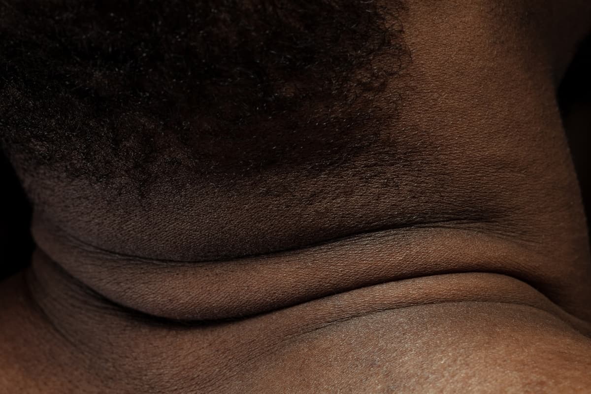 dark neck dark neck