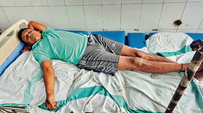 बांस हटाने के विवाद में युवक पर चलायी गोली, बाल-बाल बचेसीसीटीवी फुटेज के आधार पर पुलिस कर रही अपराधियों की तलाशफायरिंग कर दहशत फैलाते हुए भागे अपराधी, दो खोखा बरामदफोटो – राजगीर के अनुमंडलीय अस्पताल में भर्ती घायल युवकप्रतिनिधि, राजगीर.शहर के पुरानी पेट्रोल पंप के समीप एक दुकानदार पर दिनदहाड़े जानलेवा हमला करने का मामला प्रकाश में आया है. पीड़ित शहर के ही दांगी टोला निवासी प्रेम प्रकाश उर्फ पंकज ने बताया कि चार अज्ञात अपराधी उनकी दुकान पर आये. पीड़ित के विरोध करने पर एक अपराधी ने पिस्तौल से गोली चला दी, जिसमें वह बाल-बाल बच गया़ घटना के बाद सभी अपराधी फरार हो गए. भागते समय एक अन्य अपराधी ने भी हवा में फायरिंग की. पीड़ित द्वारा राजगीर थाने में एफआईआर दर्ज कराया गया है. घायल अवस्था में पंकज को अनुमंडलीय अस्पताल, राजगीर में भर्ती कराया गया है. पीड़ित प्रेम प्रकाश ने बताया कि रविवार को पीसीसी ढलाई होने के कारण बांस से रास्ता बंद किया गया था. दो बाइक सवार युवक जबरन बांस हटाने की कोशिश करने लगा. बांस को हटाने से मना करने पर मारपीट उसके द्वारा किया गया. आसपास के लोगों के हस्तक्षेप से मामला शांत हुआ. लेकिन सोमवार की सुबह करीब साढ़े दस बजे एक युवक कमरा किराये पर लेने के बहाने उन्हें बुलाया. तभी चारों युवकों द्वारा उसपर अचानक हमला कर दिया और फायरिंग करते हुए फरार हो गया. घटना की सूचना पर पुलिस मौके से दो कारतूस का खोखा बरामद किया है. थानाध्यक्ष रमण कुमार ने घटना की पुष्टि की है. उन्होंने बताया कि आसपास के सीसीटीवी कैमरों में चारों आरोपियों की तस्वीरें और गतिविधियां कैद हुई हैं. पुलिस टीम उनकी गिरफ्तारी के लिए लगातार छापेमारी कर रही है. उन्होंने कहा कि बहुत जल्द ही आरोपियों को पकड़ लिया जाएगा.