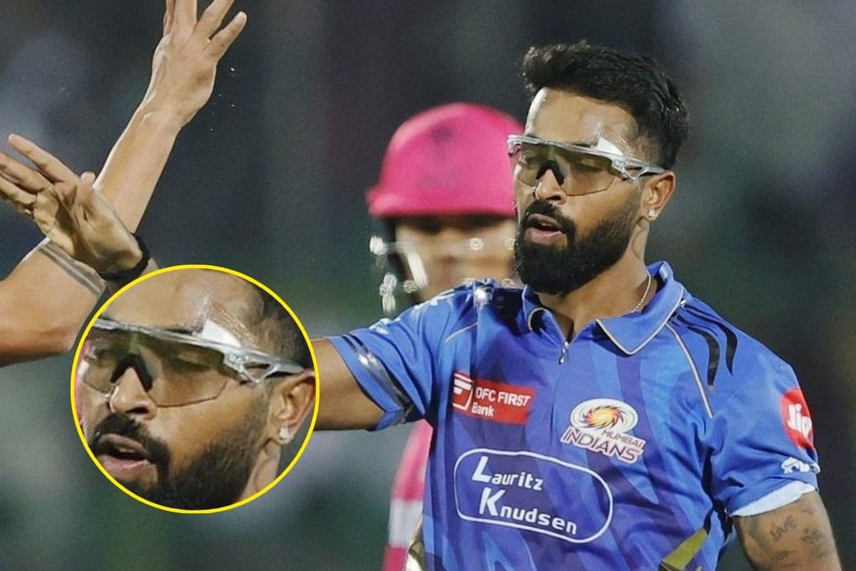 Hardik Pandya Played with Stitches on Eyebrows. Hardik Pandya Played with Stitches on Eyebrows.