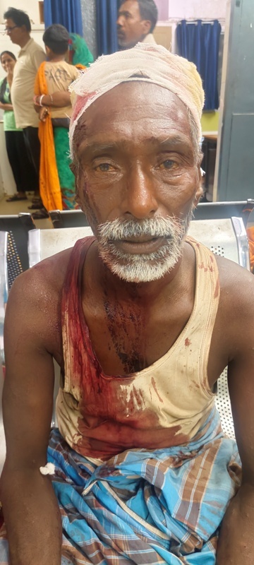 दो गोतिया में हुई मारपीट, आधा दर्जन जख्मी