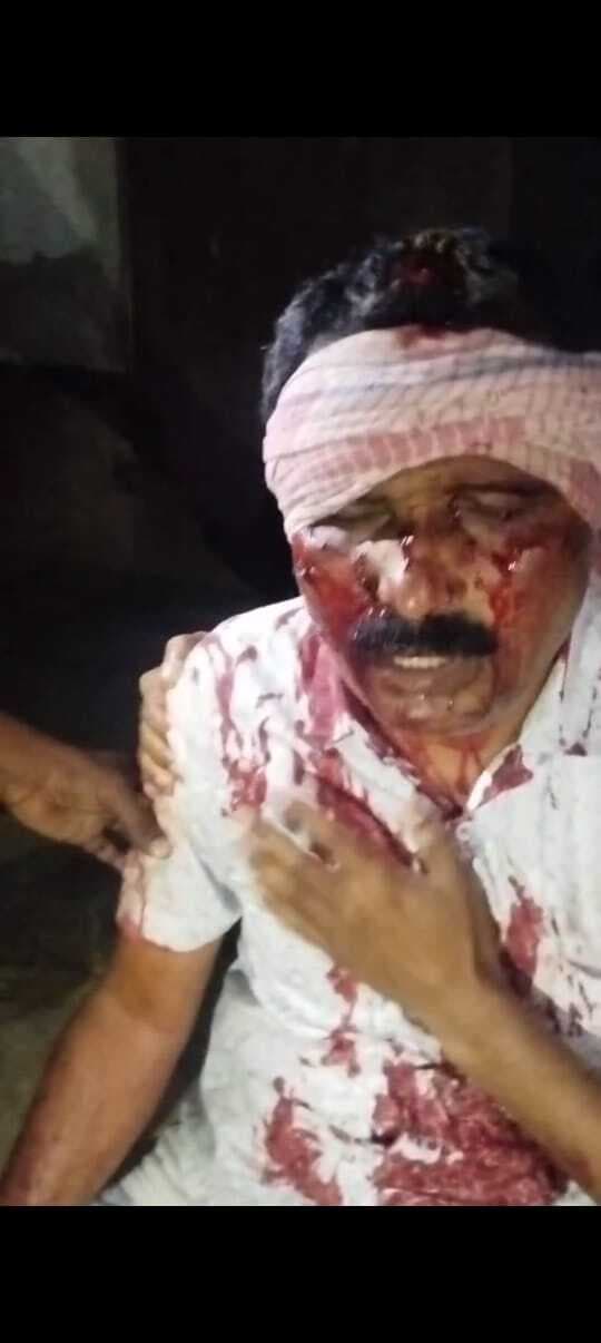 गोली लगने से अधेड़ व्यक्ति घायल, मामला दर्ज