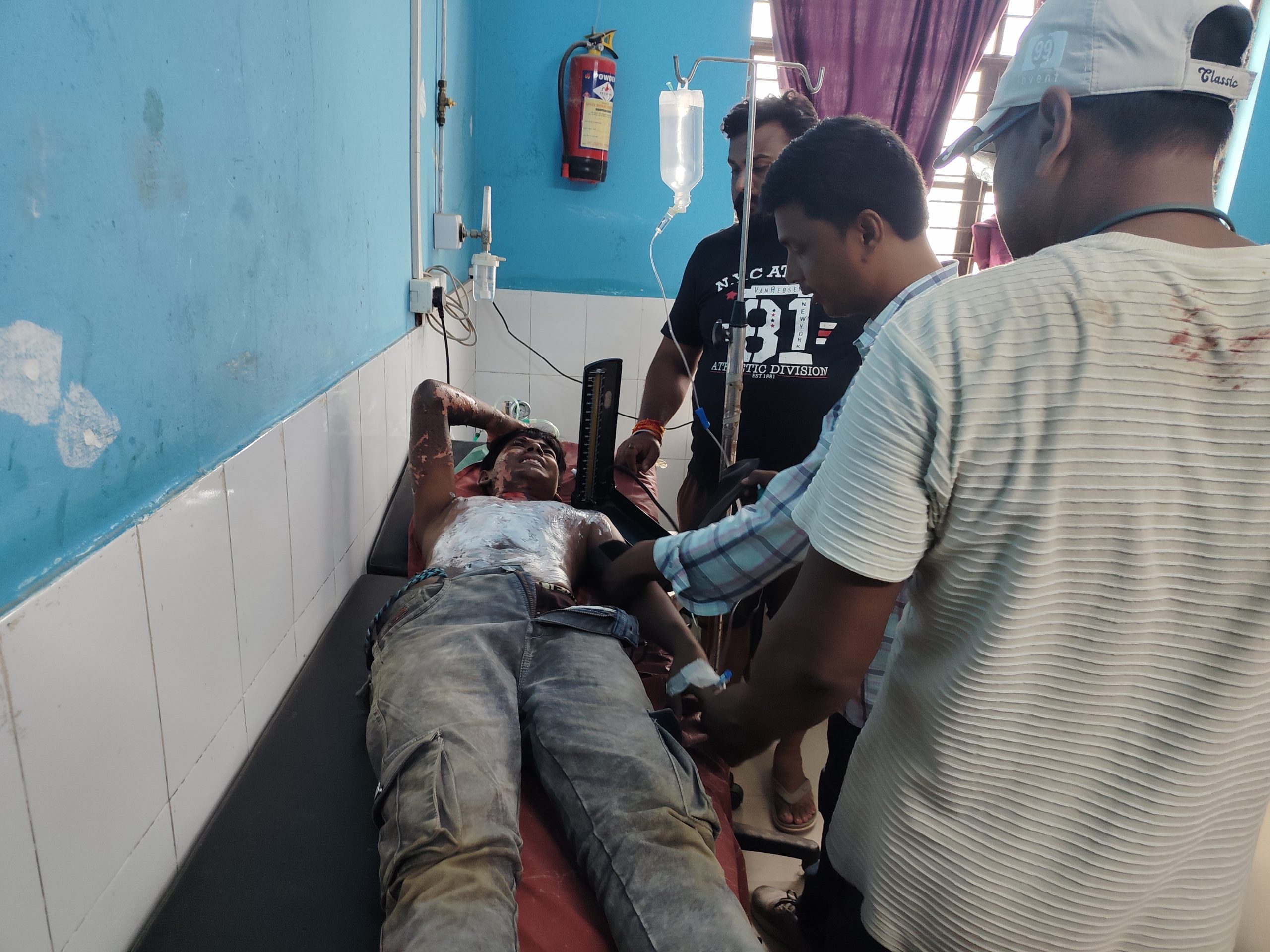 मालगाड़ी के इंजन पर रील्स बना रहे दो किशोर झुलसे, एक की हालत गंभीर