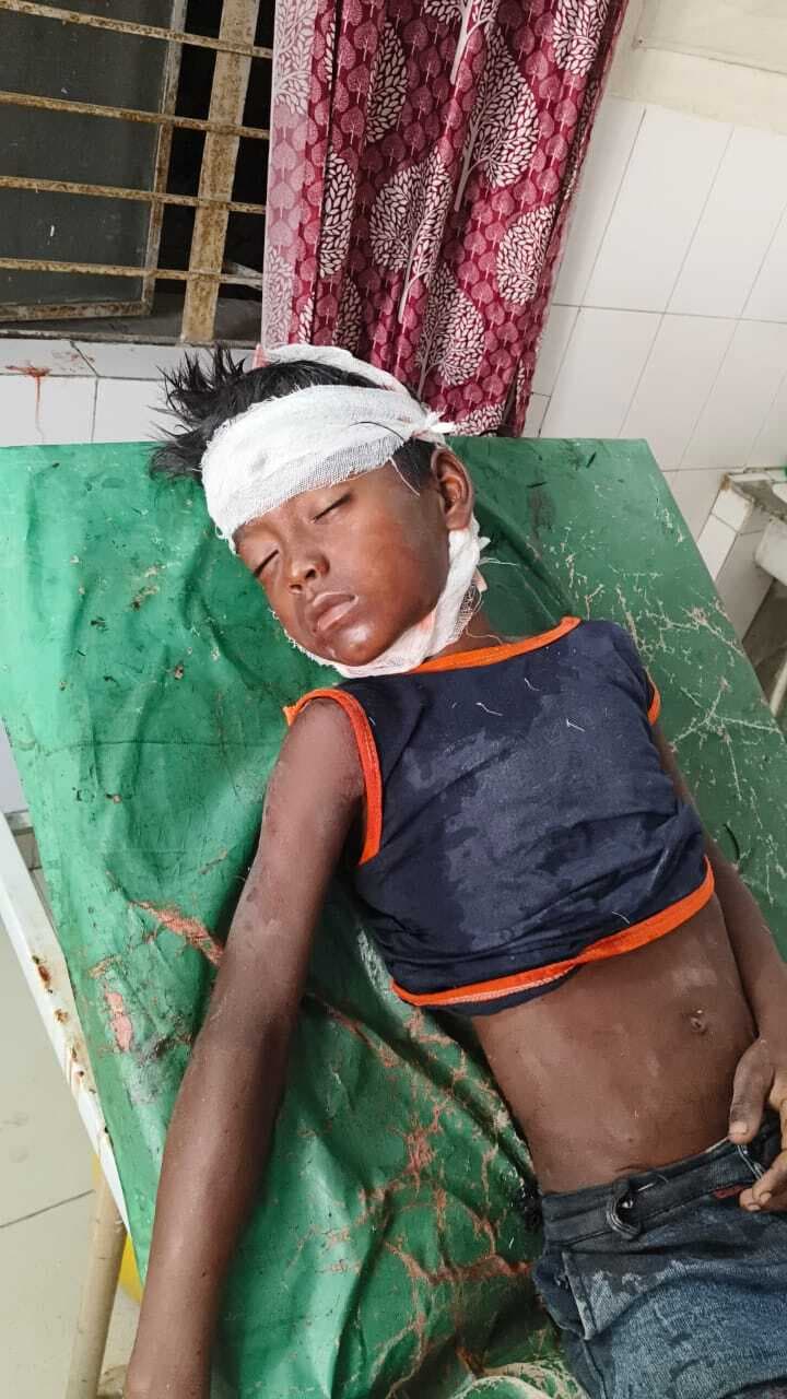 ट्रेन से गिरकर 10 वर्षीय बालक घायल