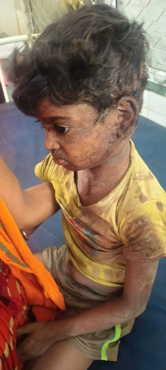 मोबाइल के लोभ में आकर मासूम पर जानलेवा हमला, गिरफ्तार