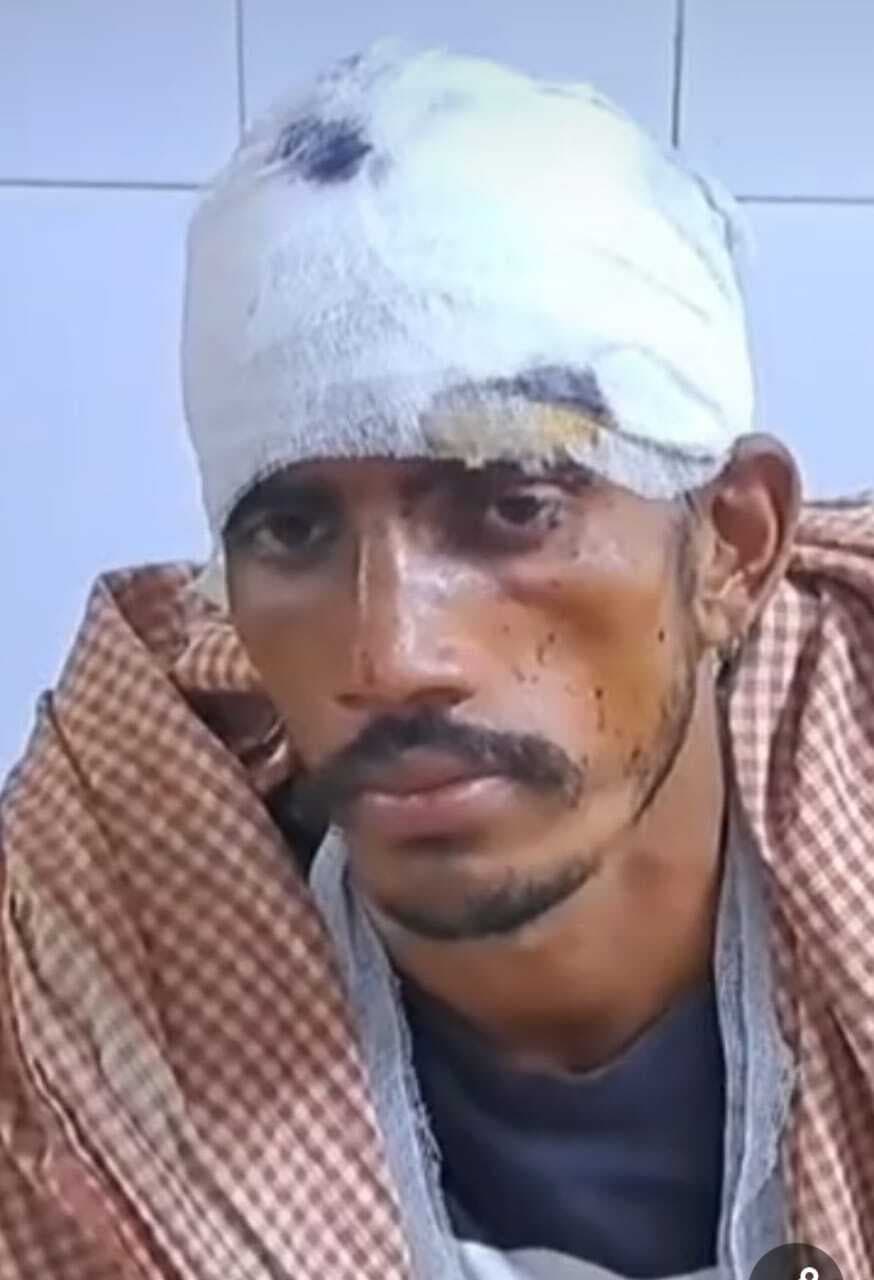 मवेशी बधाने के विवाद में मारपीट, एक घायल