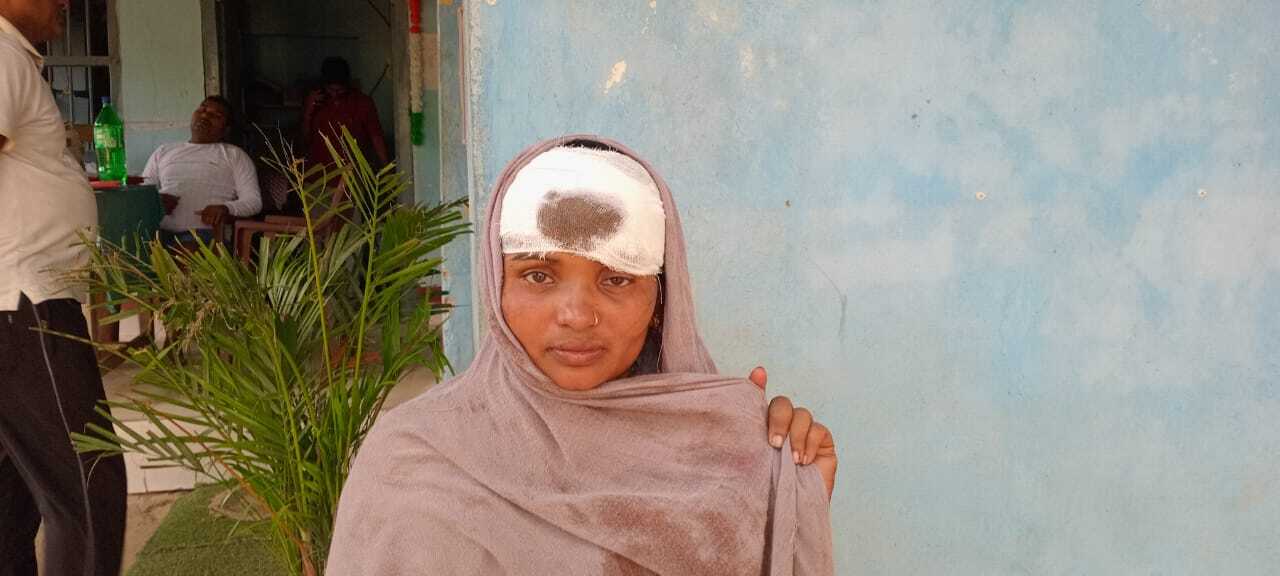 बच्चों के विवाद में बड़ों के बीच मारपीट, महिला जख्मी