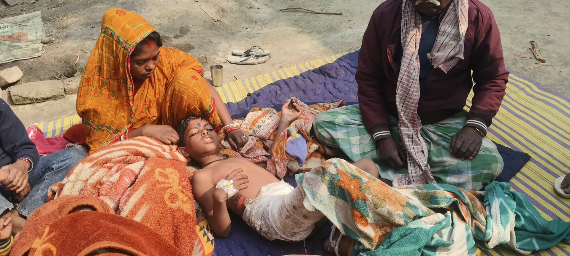 पतंग उतारने में बिजली की चपेट में आया किशोर, झुलसा