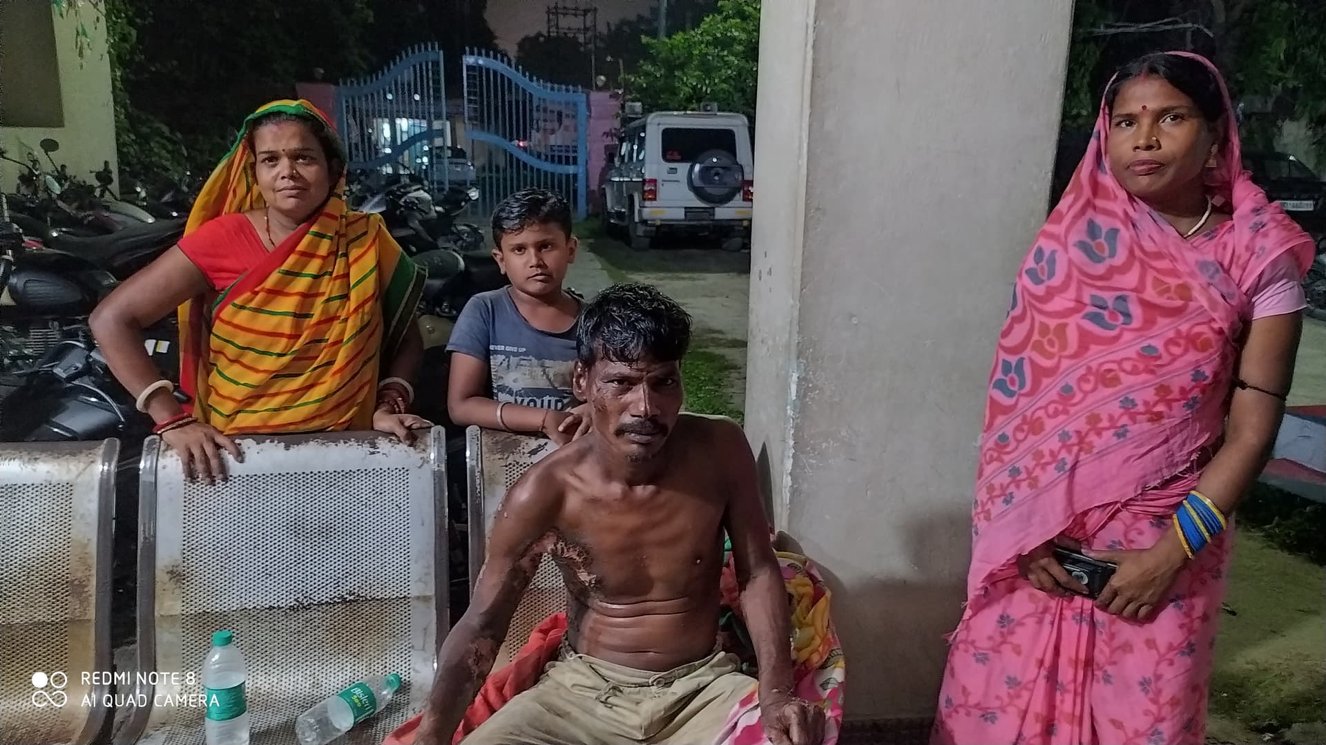 कर्नाटक में मजदूरी करने गए बिहार के मजदूर पर कथित एसिड अटैक, पत्नी ने थाने में लगाई न्याय की गुहार
