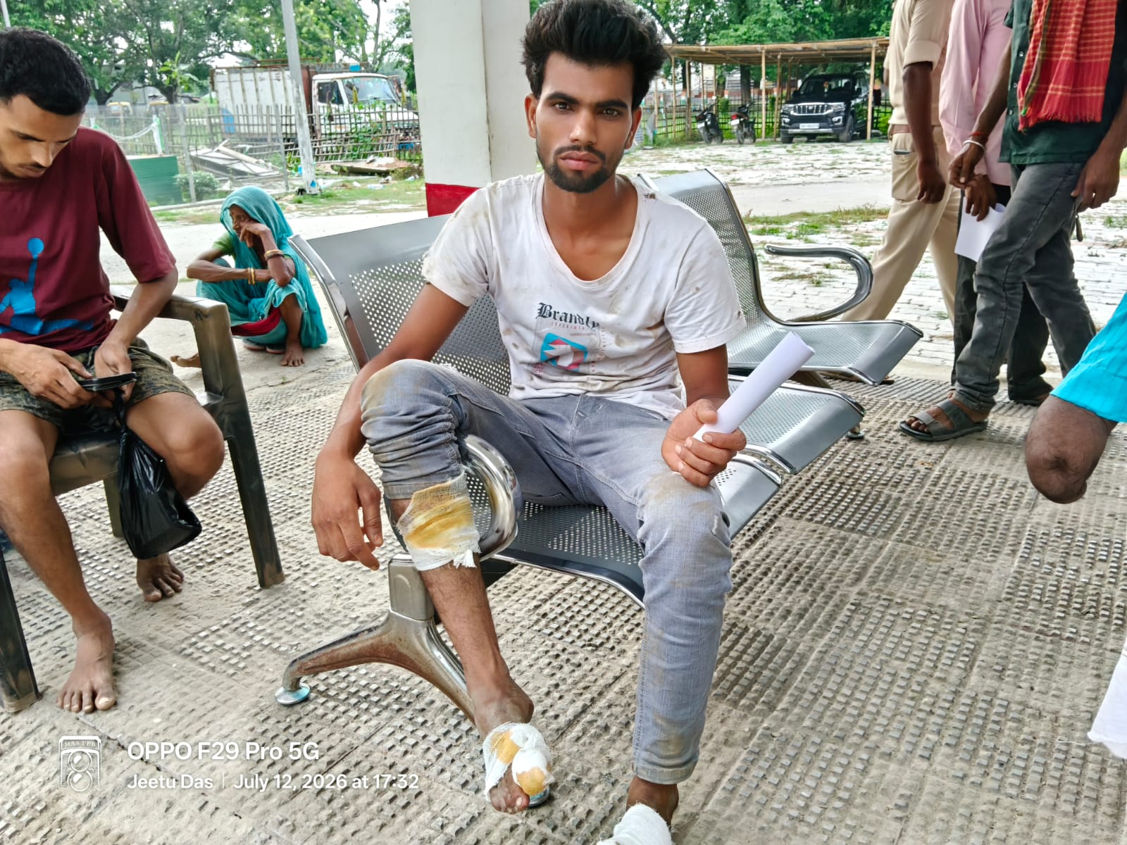 सीसीटीवी लगाने के विवाद में फायरिंग, युवक को लगी गोली