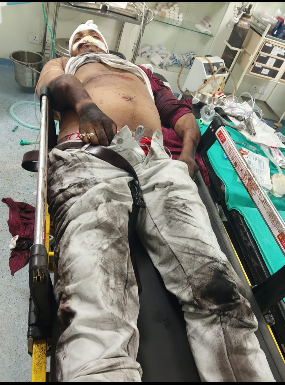 हाइवा वाहन की टक्कर से युवक की मौत, पुलिस ने वाहन जब्त किया