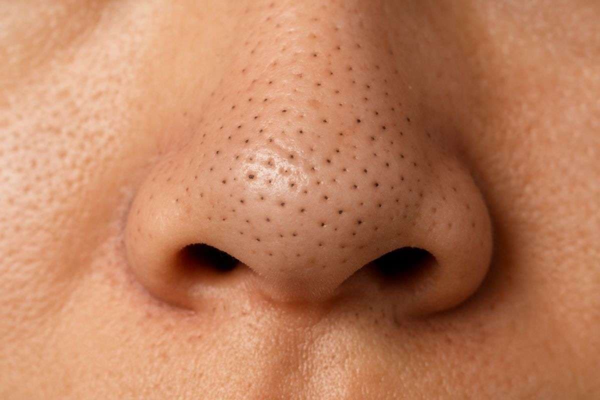How To Remove Blackheads From Nose: चेहरे की खूबसूरती रहेगी बरकरार, नाक से ब्लैकहेड्स हटाने के लिए अपनाएं ये टिप्स
