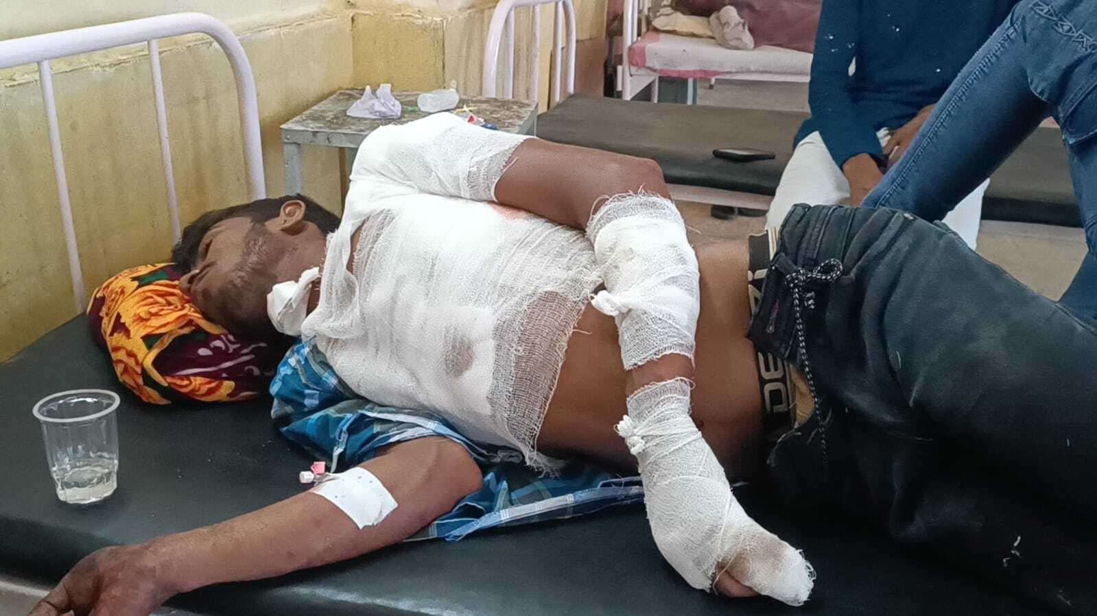 Dhanbad News: चाकूबाजी की घटना में कुमारधुबी का युवक घायल