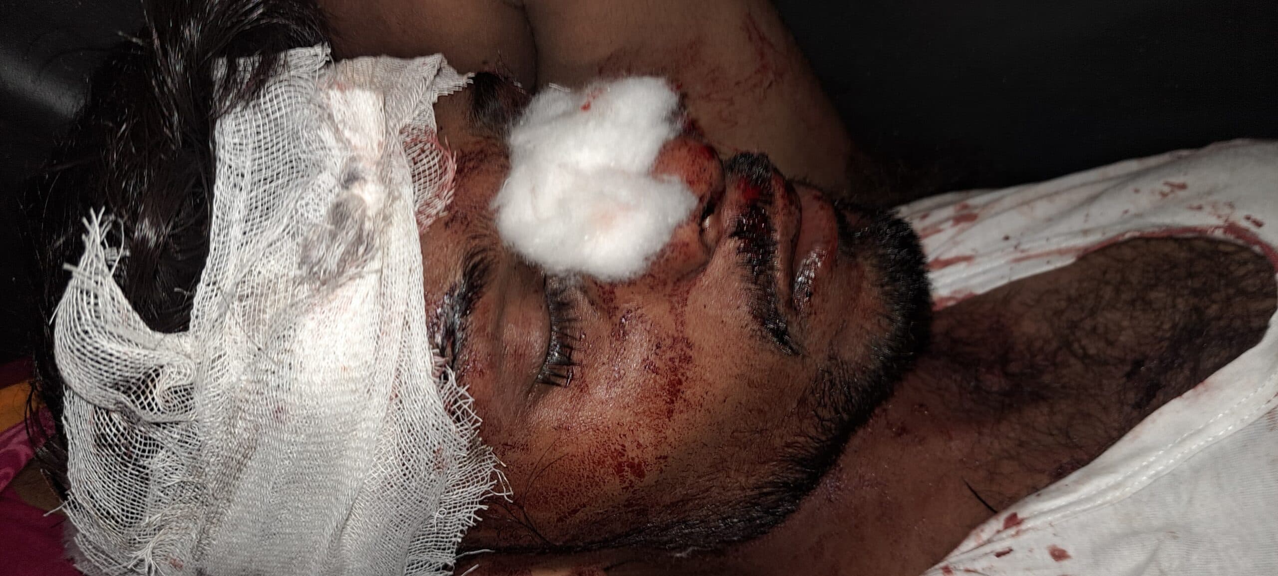 दो बाइक की सीधी टक्कर में चार जख्मी, एक रेफर