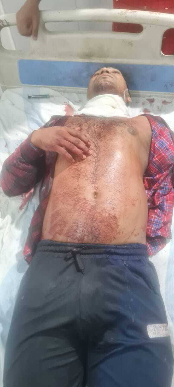 सनकी जीजा ने साला का गला रेता, रेफर