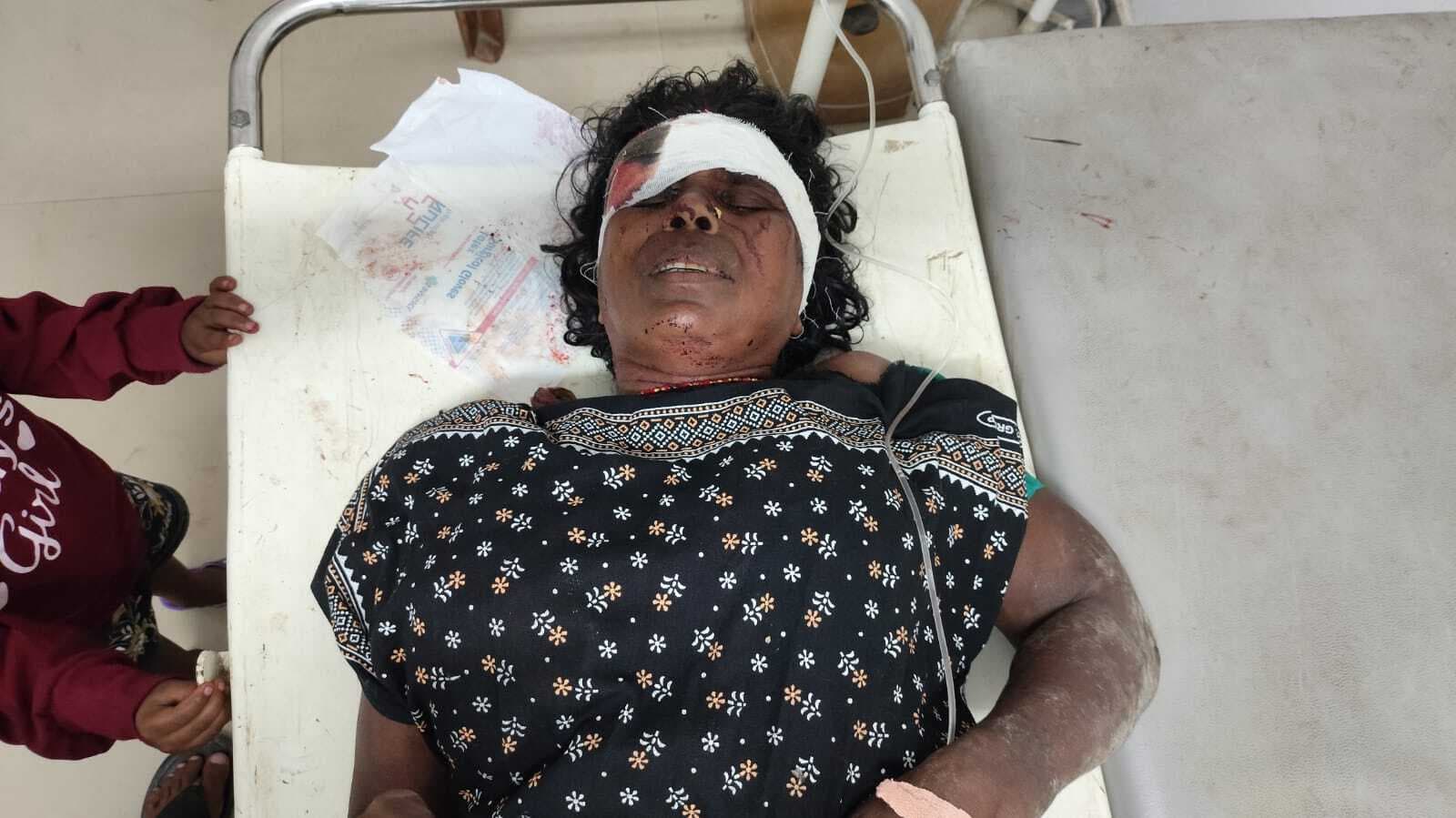 12 डिसमिल जमीन को लेकर हुई मारपीट, एक महिला गंभीर रूप से घायल