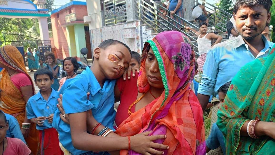 विद्यालय में अपने साथियों द्वारा की गई पिटाई से छात्र जख्मी