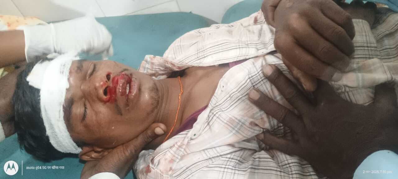 बाइक की टक्कर से एक व्यक्ति घायल