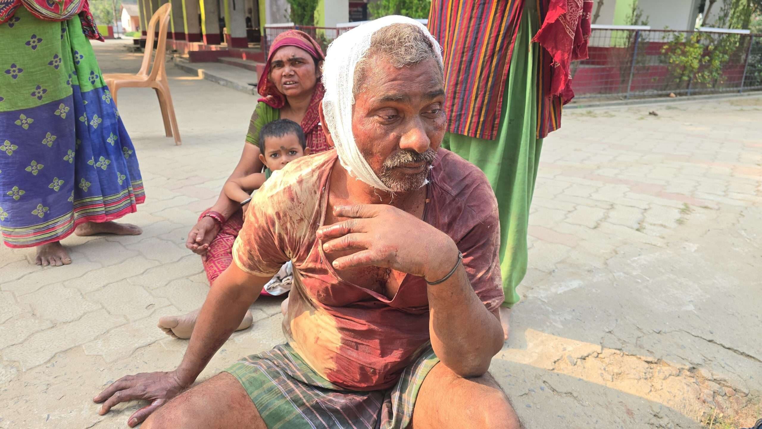 जमीनी विवाद को लेकर साला-जीजा के बीच जमकर हुई मारपीट