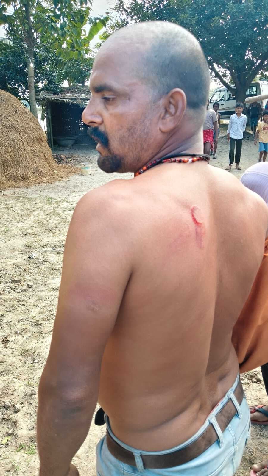 कोढ़ा में लाल कार्डधारी की जमीन पर दबंगों का उत्पात, विरोध करने पर भूमिहीन परिवारों के साथ मारपीट