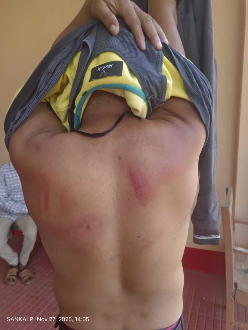 कोचिंग संचालक को ससुराल वालों ने घर में घुसकर बेरहमी से पीटा