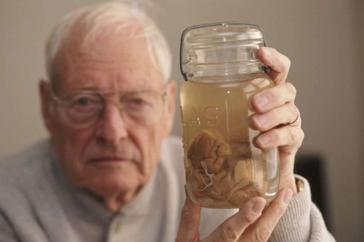 Albert Einstein Brain Stored In A Jar