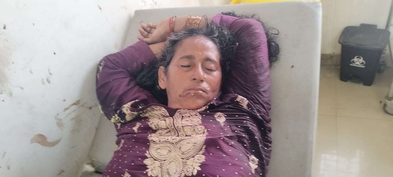 सड़क दुर्घटना में महिला जख्मी