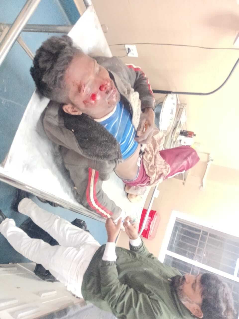 एनएच-107 पर डिवाइडर से टकरायी बाइक, तीन घायल