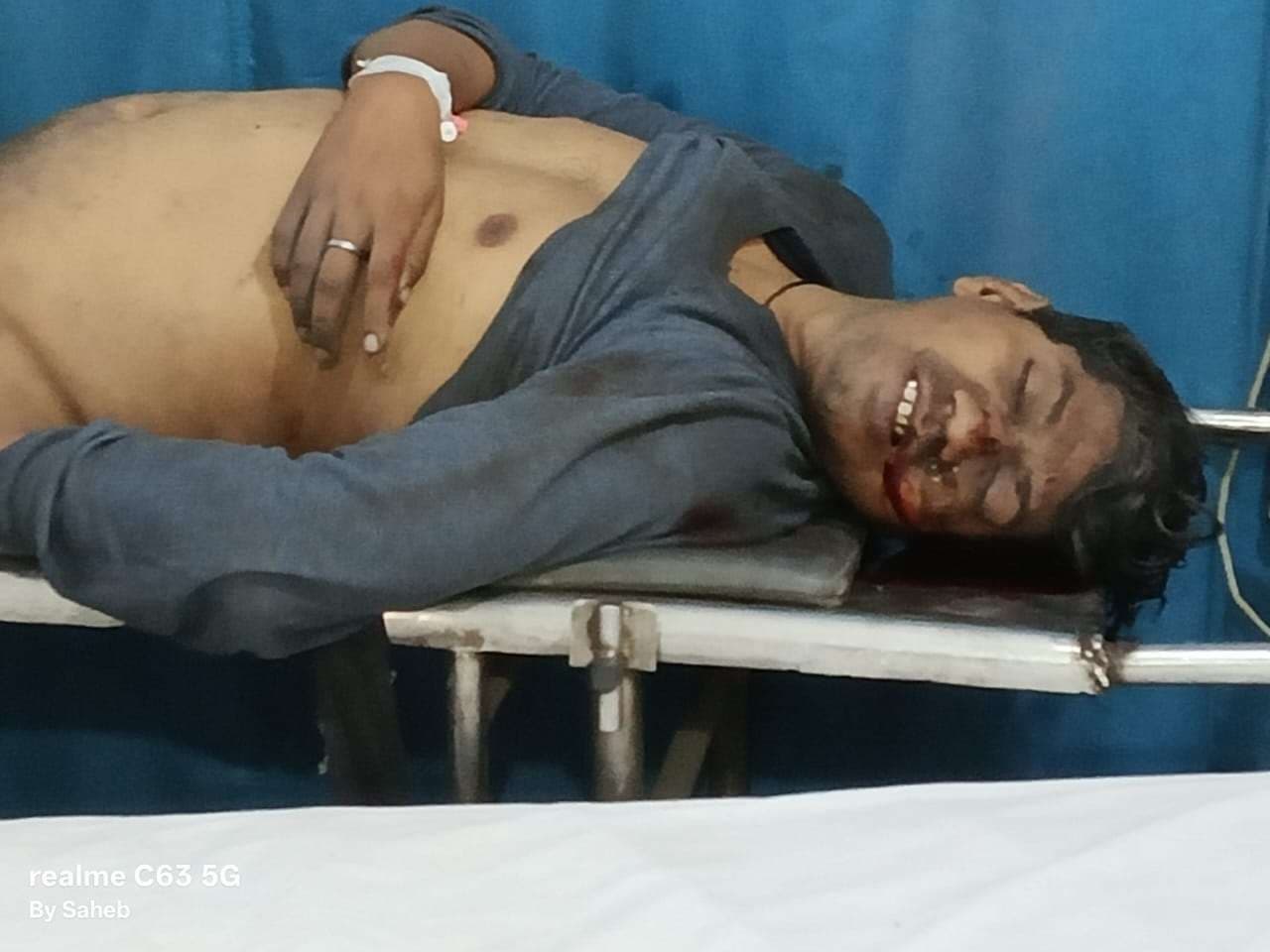 Bokaro News : एएडीओसीएम परियोजना में ओवरबर्डन धंसा, ठेका मजदूर की दबकर मौत