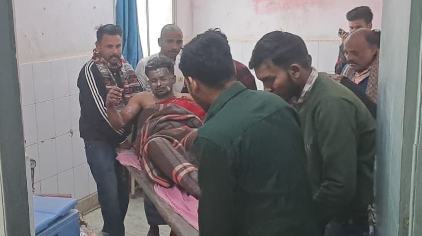 पेट्रोल में आग लगने से दुकानदार झुलसा