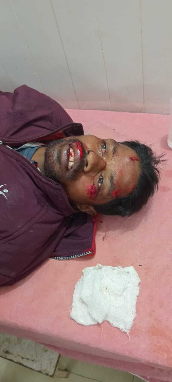 स्कॉर्पियो ने बाइक को मारी टक्कर, चालक घायल