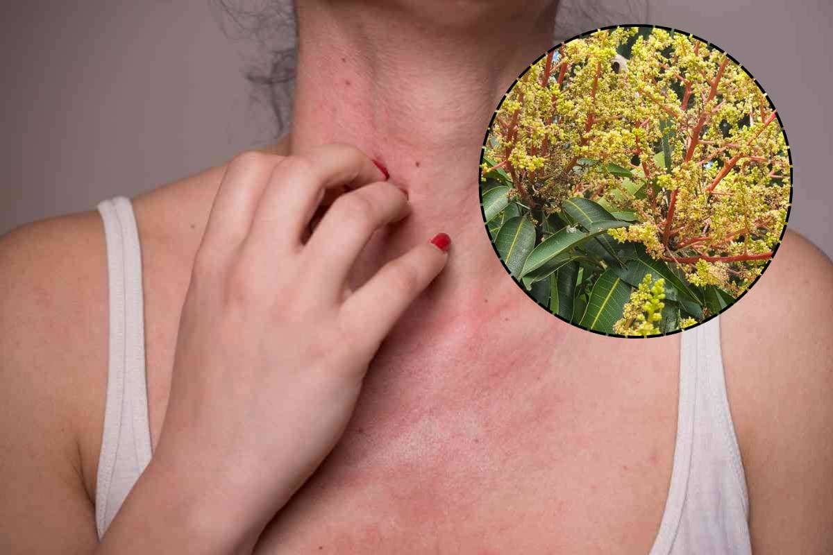 आम के बौर से बढ़ सकती हैं एलर्जी और सांस की समस्या, जानें कितना है खतरा