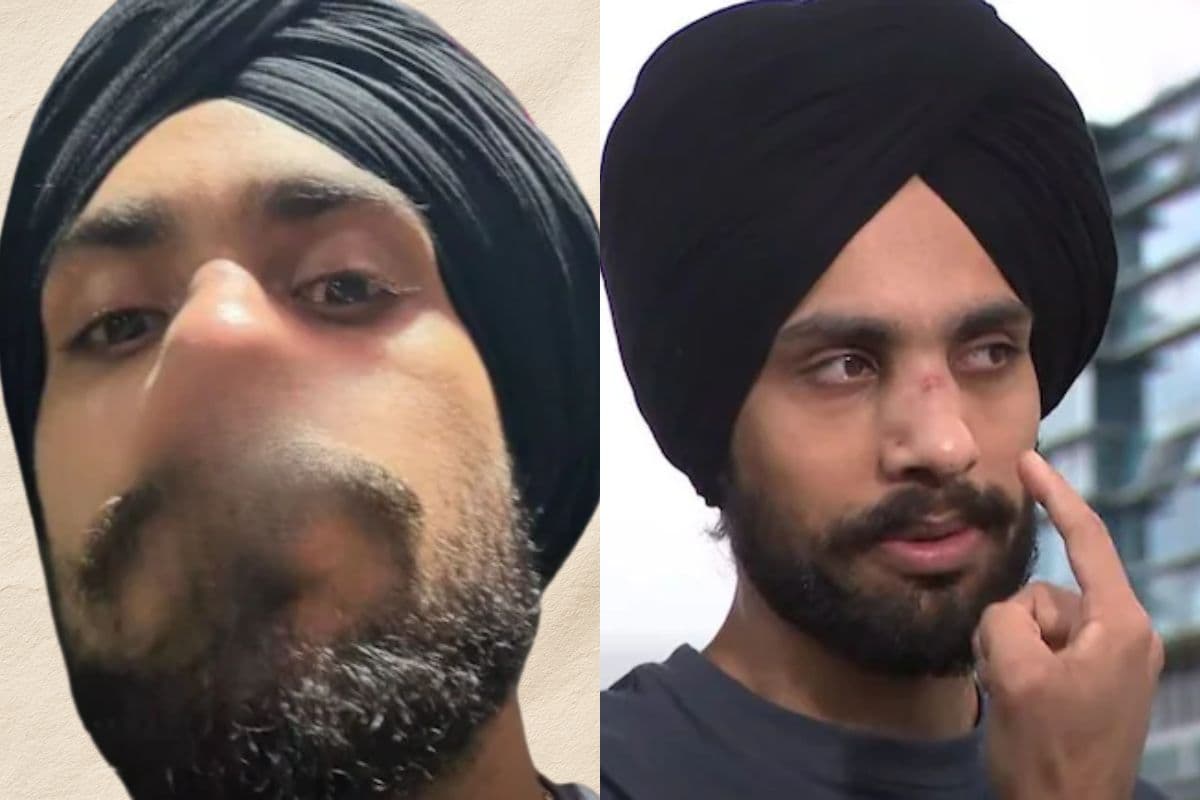 ‘इंडियन डॉग’ बोलकर तोड़ी नाक, ऑस्ट्रेलिया में जिम के बाहर सिख युवक को घेरकर पीटा