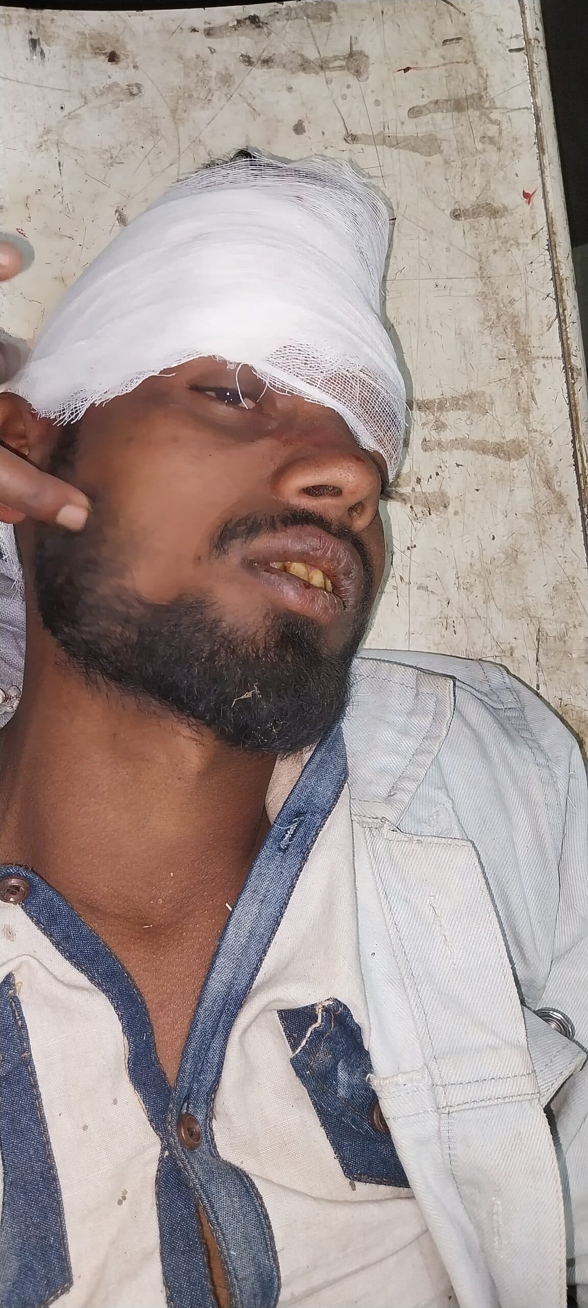 Giridih News :बिरनी में बाइकों की टक्कर में दो युवक घायल, रेफर