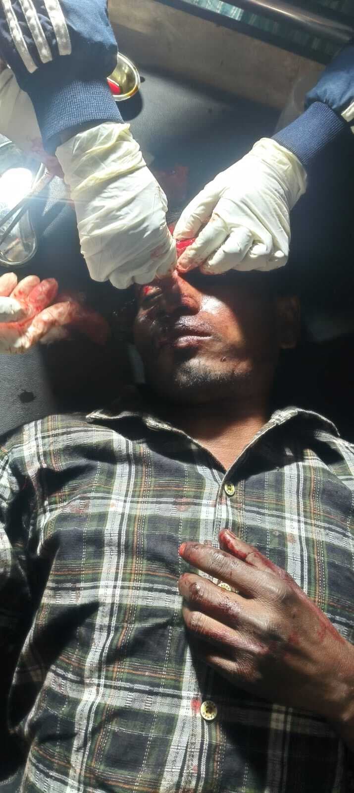 मेले से लौट रहे युवक को हाइवा ने मारी टक्कर, दुमका रेफर