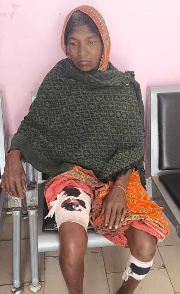 हायना के हमले से महिला घायल