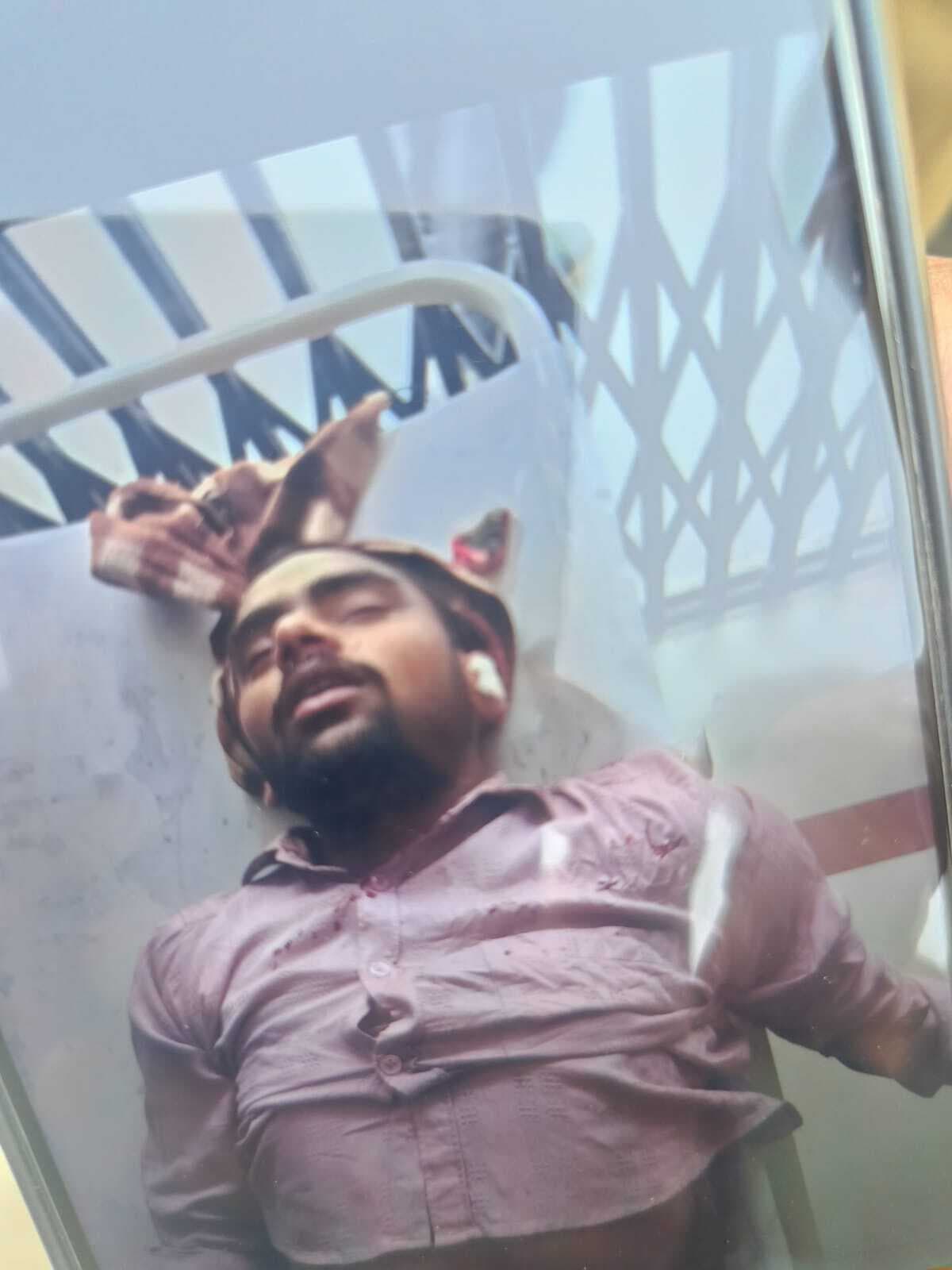 बाइक से गिरकर युवक जख्मी