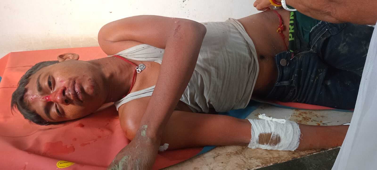 दो बाइक की टक्कर में एक जख्मी