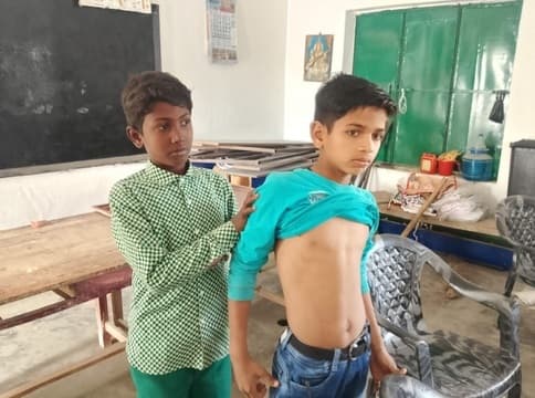 शोभापुर सुखाड़ी विद्यालय में छात्रों को विषैले कीड़े ने काटा, अफरा-तफरी का माहौल