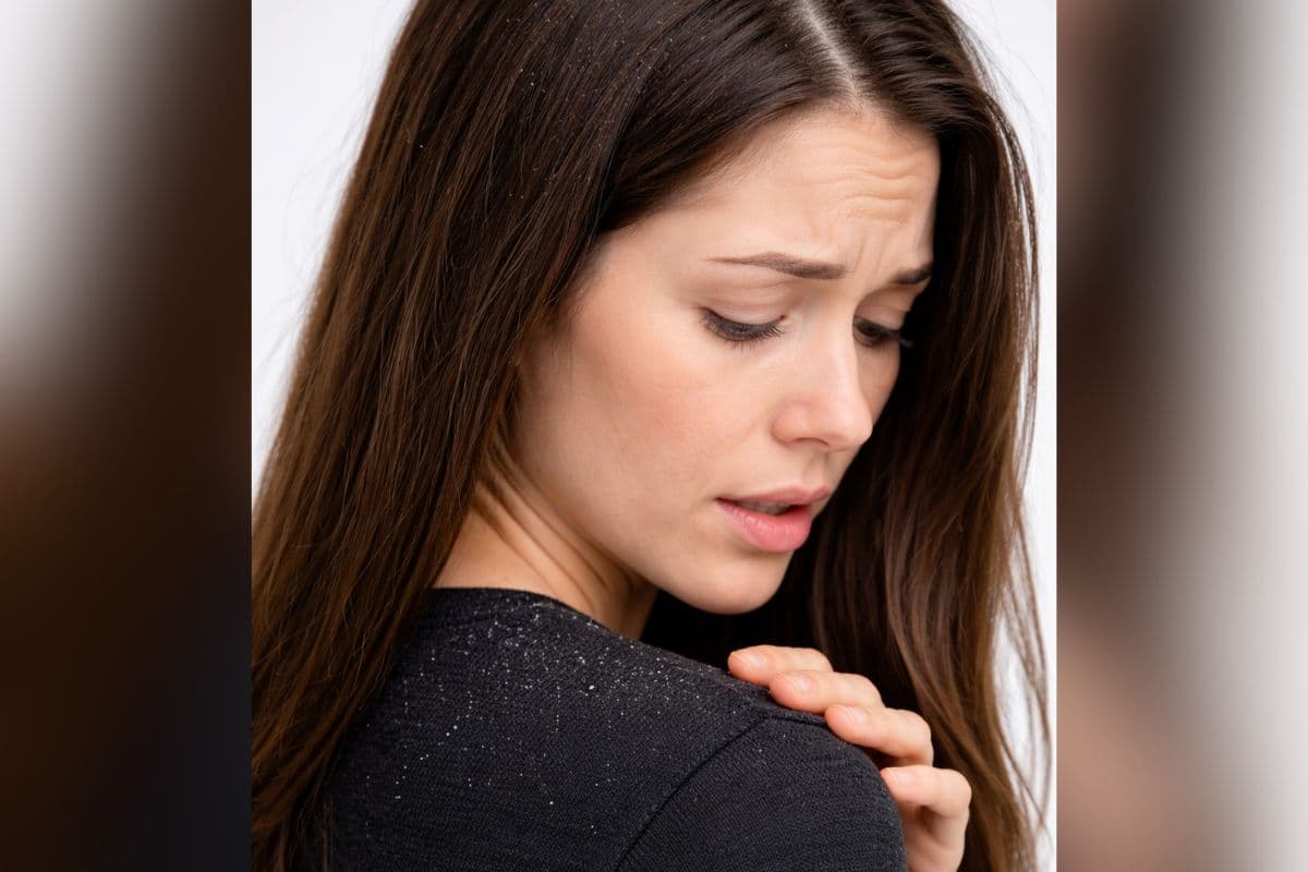 डैंड्रफ से पाएं छुटकारा, अपनाएं हंसाजी की ये तरीके