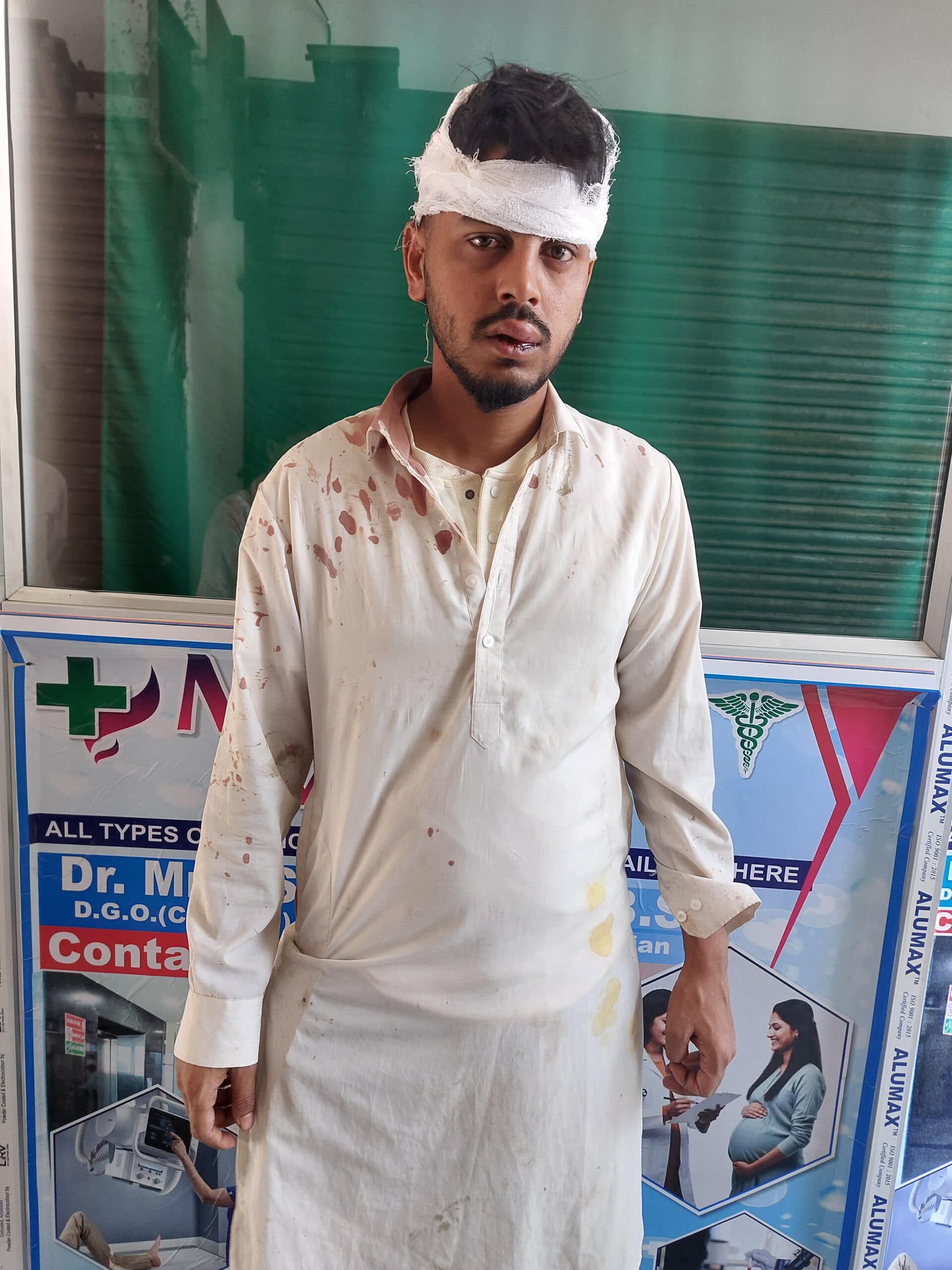 जलसा में दो गुटों के बीच मारपीट, एक युवक घायल, मामला दर्ज