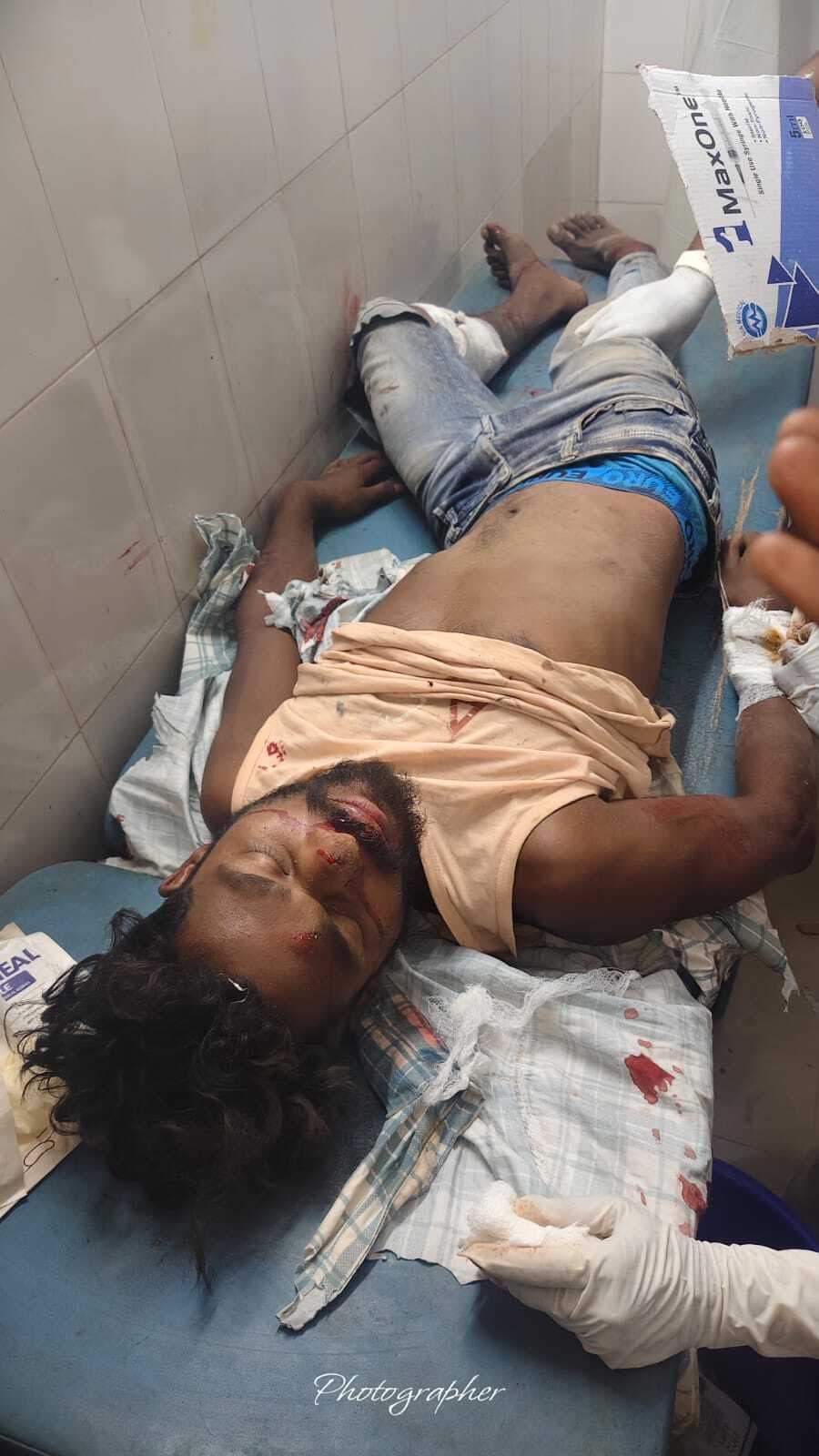 पुलिस के ट्रक से टकरायी बाइक, चालक घायल