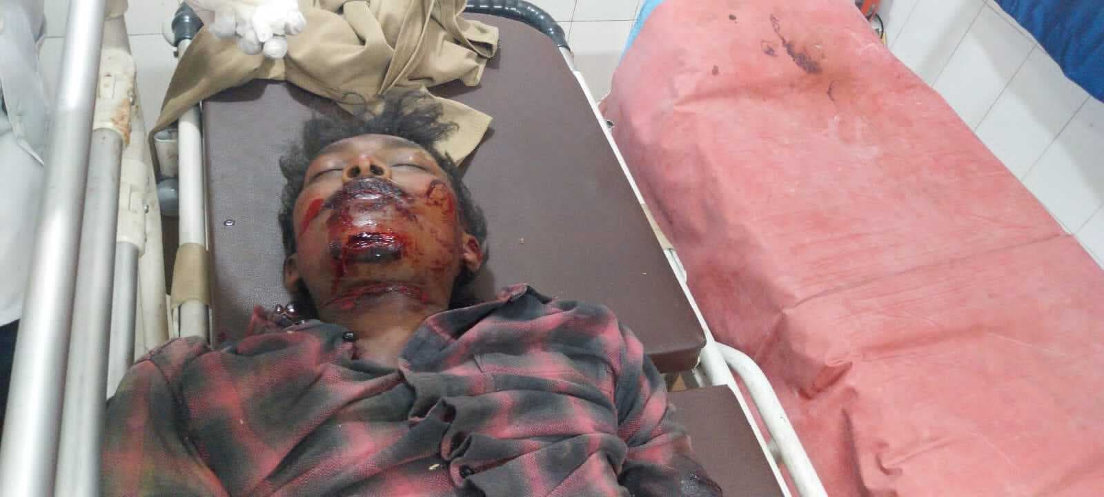 Seraikela Kharsawan News : एनएच-33 और वन-वे पुल पर हादसों में तीन की मौत