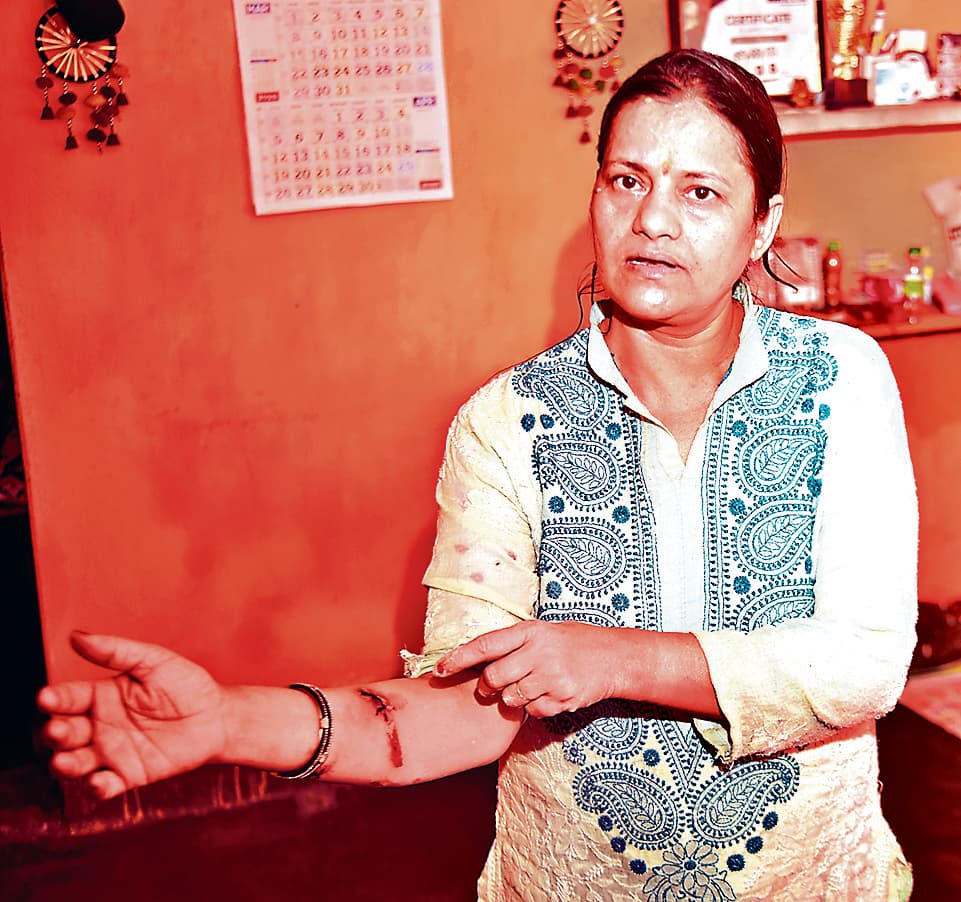 Jamshedpur News : साकची गुरुद्वारा के आसपास कुत्तों ने कई लोगों को काटा