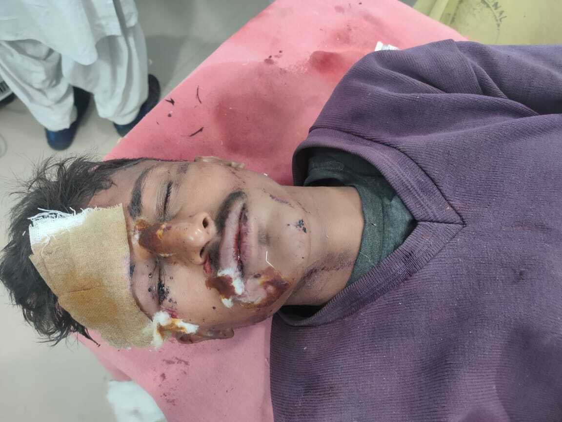 वाहन की चपेट में आने से युवक घायल