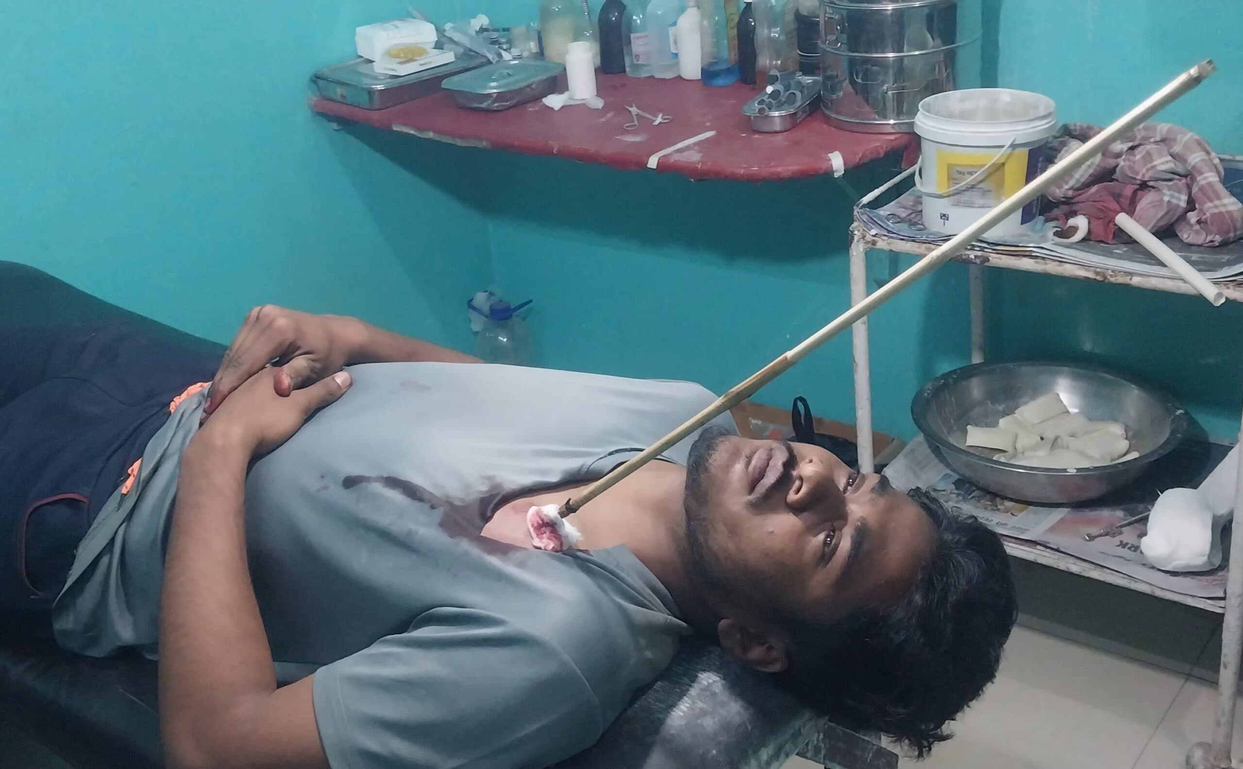 Dhanbad News: जमीन विवाद को लेकर दो पक्ष भिड़े, युवक को लगा तीर