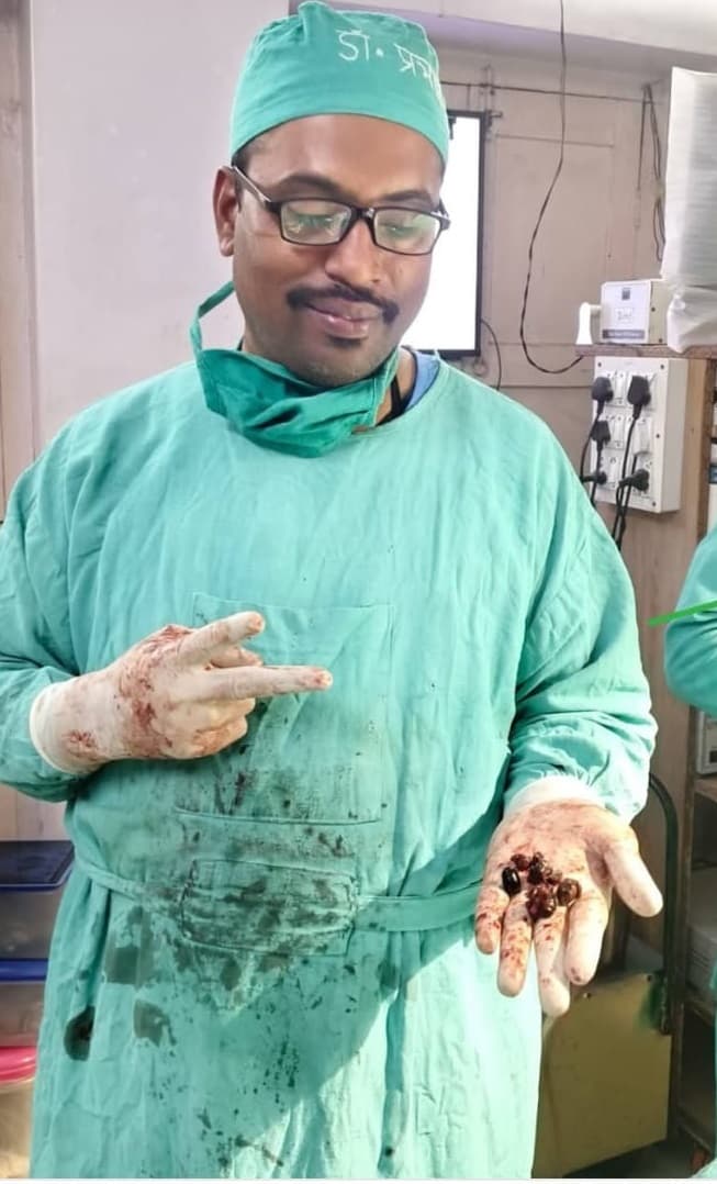 लैप्रोस्कोपिक सर्जन डॉ प्रभात ने मरीज के किडनी से एक साथ निकाला आठ पथरी, बचाई जान