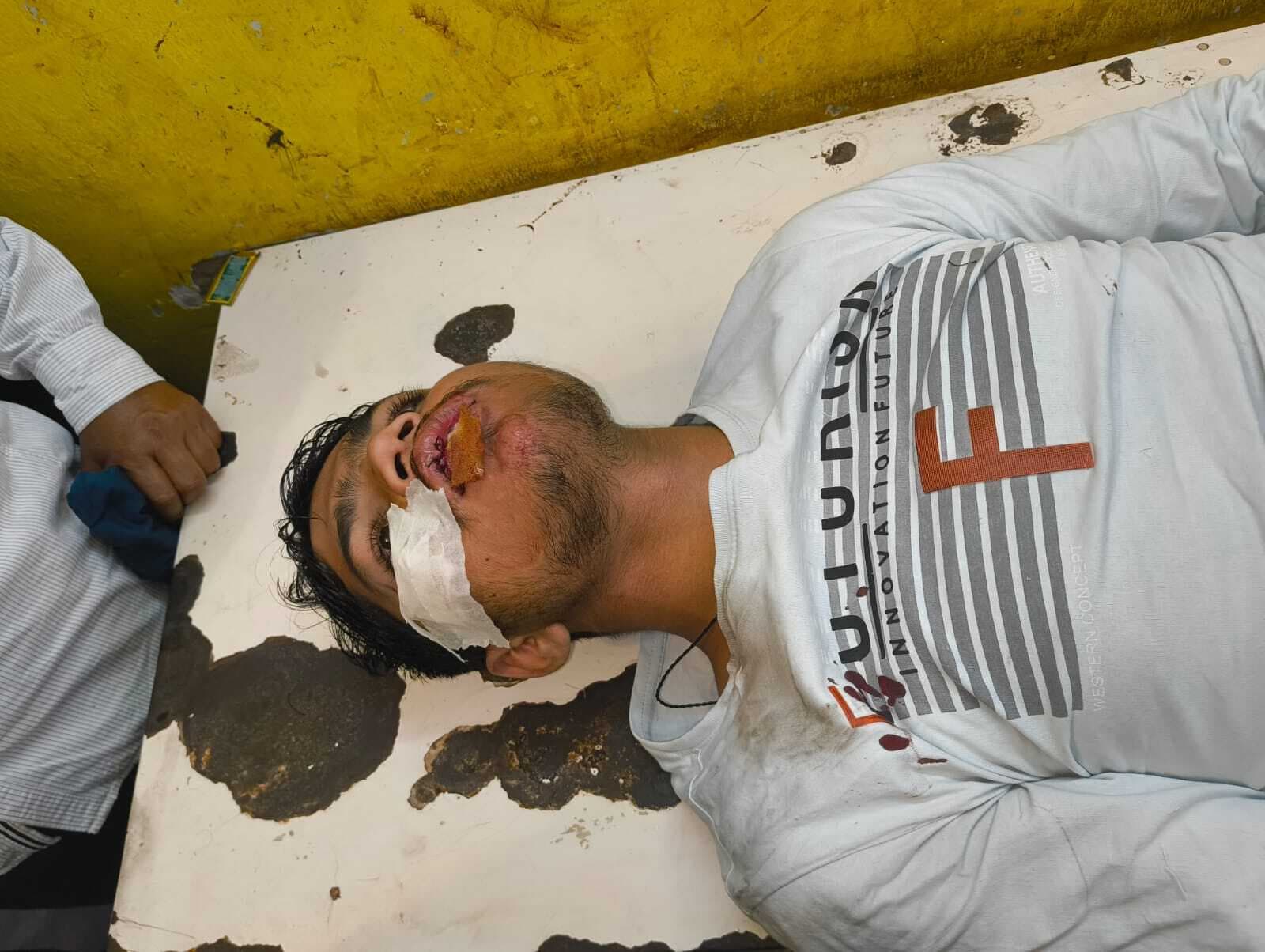 तेज रफ्तार कार ने किशोर को मारी टक्कर, हालत गंभीर