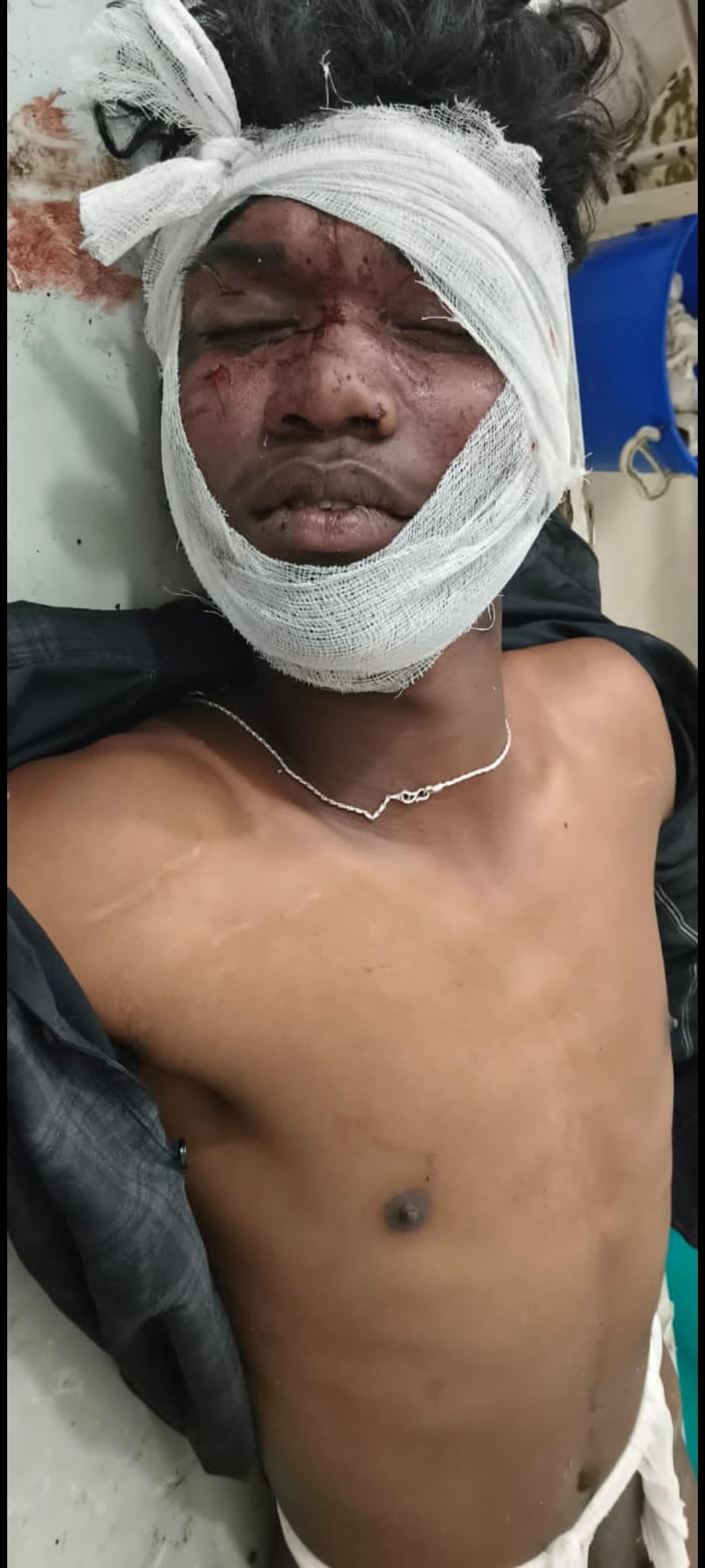 कुड़ू में बोलेरो और बाइक की भिड़ंत, युवती समेत दो की मौत, एक गंभीर