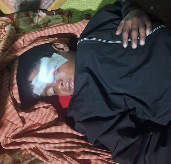 दुकानदार ने बालक का फोड़ा था आंख, अब खर्च देने से किया मना