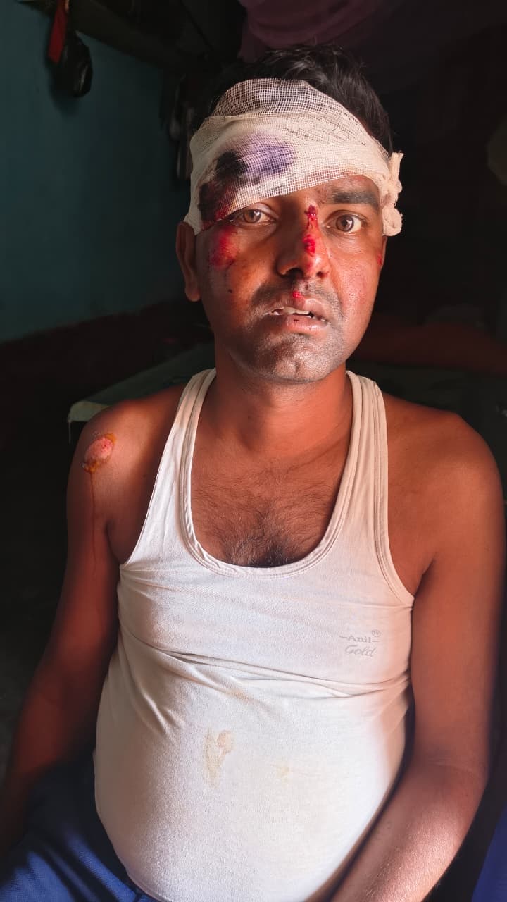 हादसा : टेंपो व बाइक में आमने-सामने की हुई टक्कर, तीन घायल